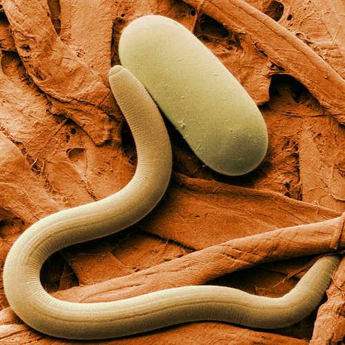 Тест «Беспозвоночные: тип Круглые черви»